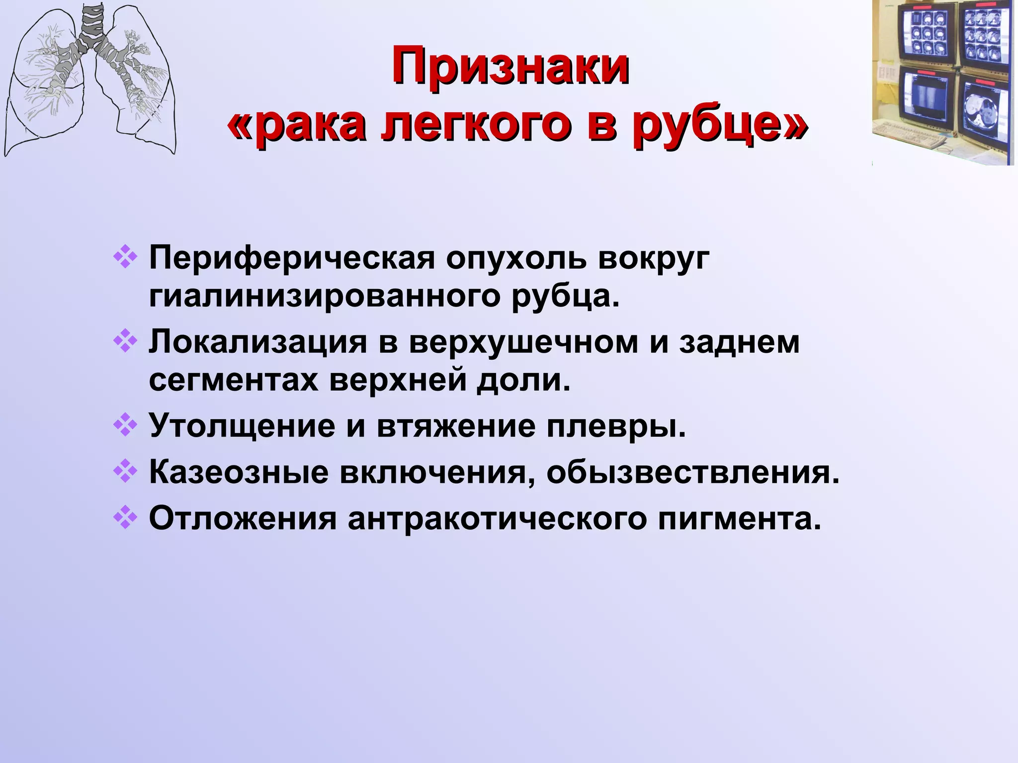 Признаки  «рака легкого в рубце» Периферическая опухоль вокруг гиалинизированного рубца. Локализация в верхушечном и заднем сегментах верхней доли. Утолщение и втяжение плевры. Казеозные включения, обызвествления. Отложения антракотического пигмента. 
