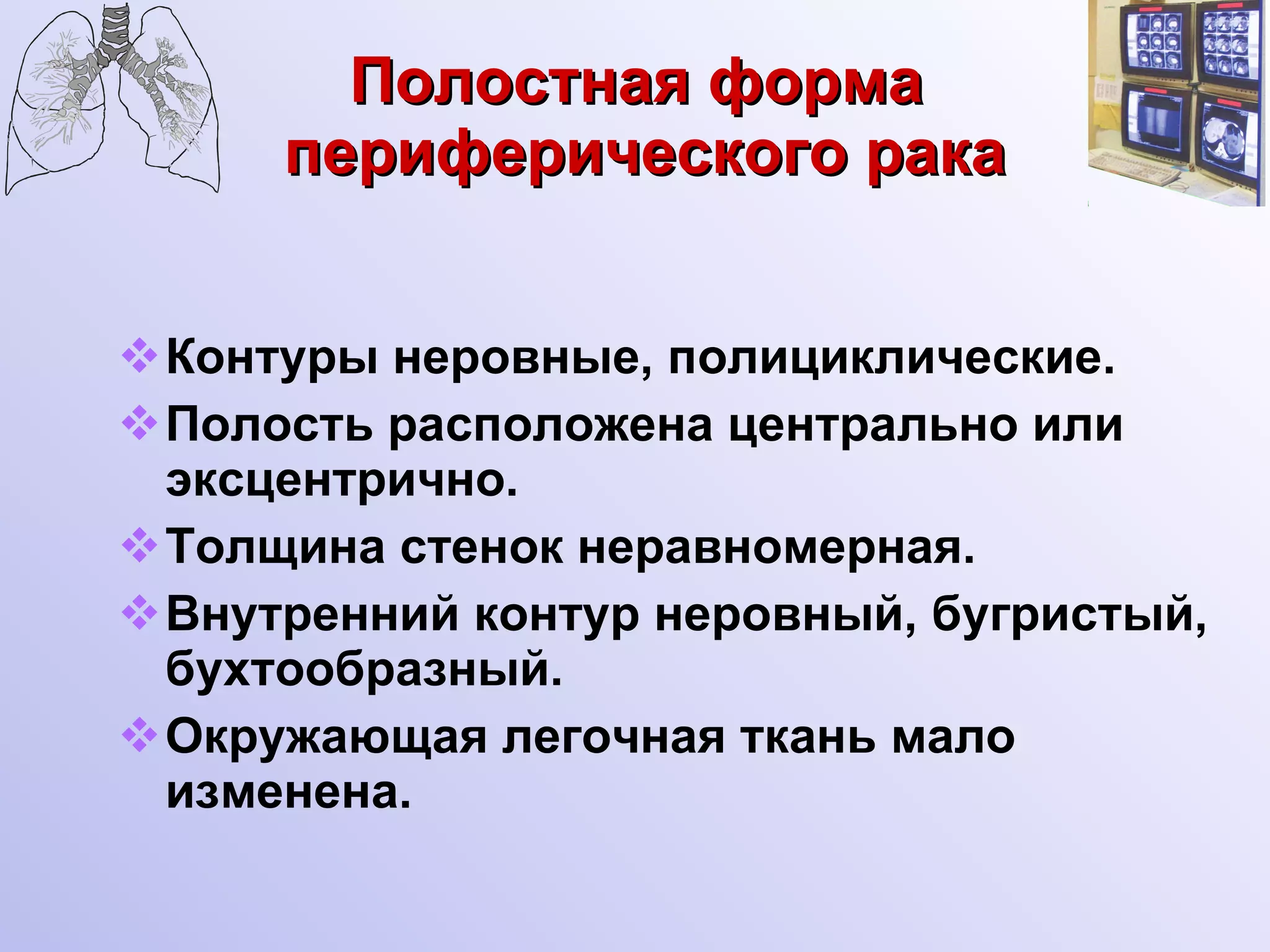 Полостная форма  периферического рака Контуры неровные, полициклические. Полость расположена центрально или эксцентрично. Толщина стенок неравномерная. Внутренний контур неровный, бугристый,  бухтообразный. Окружающая легочная ткань мало изменена. 