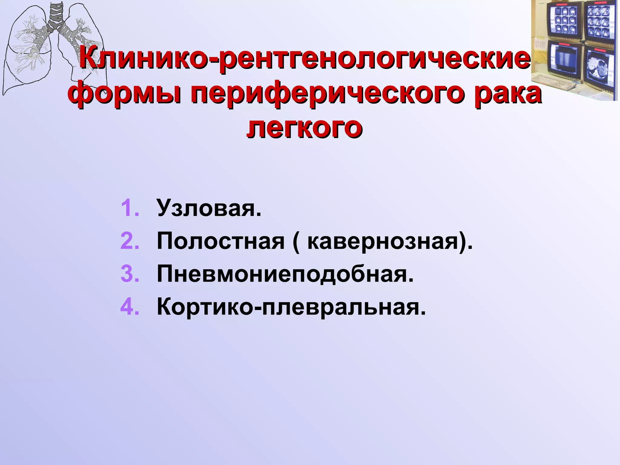 Клинико-рентгенологические формы периферического рака легкого Узловая. Полостная ( кавернозная). Пневмониеподобная. Кортико-плевральная. 