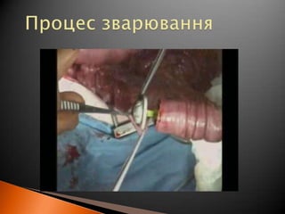 Процес зварювання
