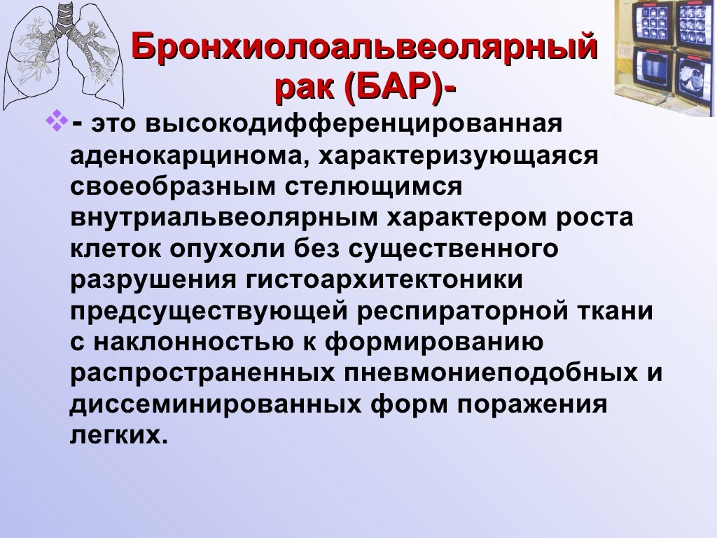 высокодифференцированная аденокарцинома форум