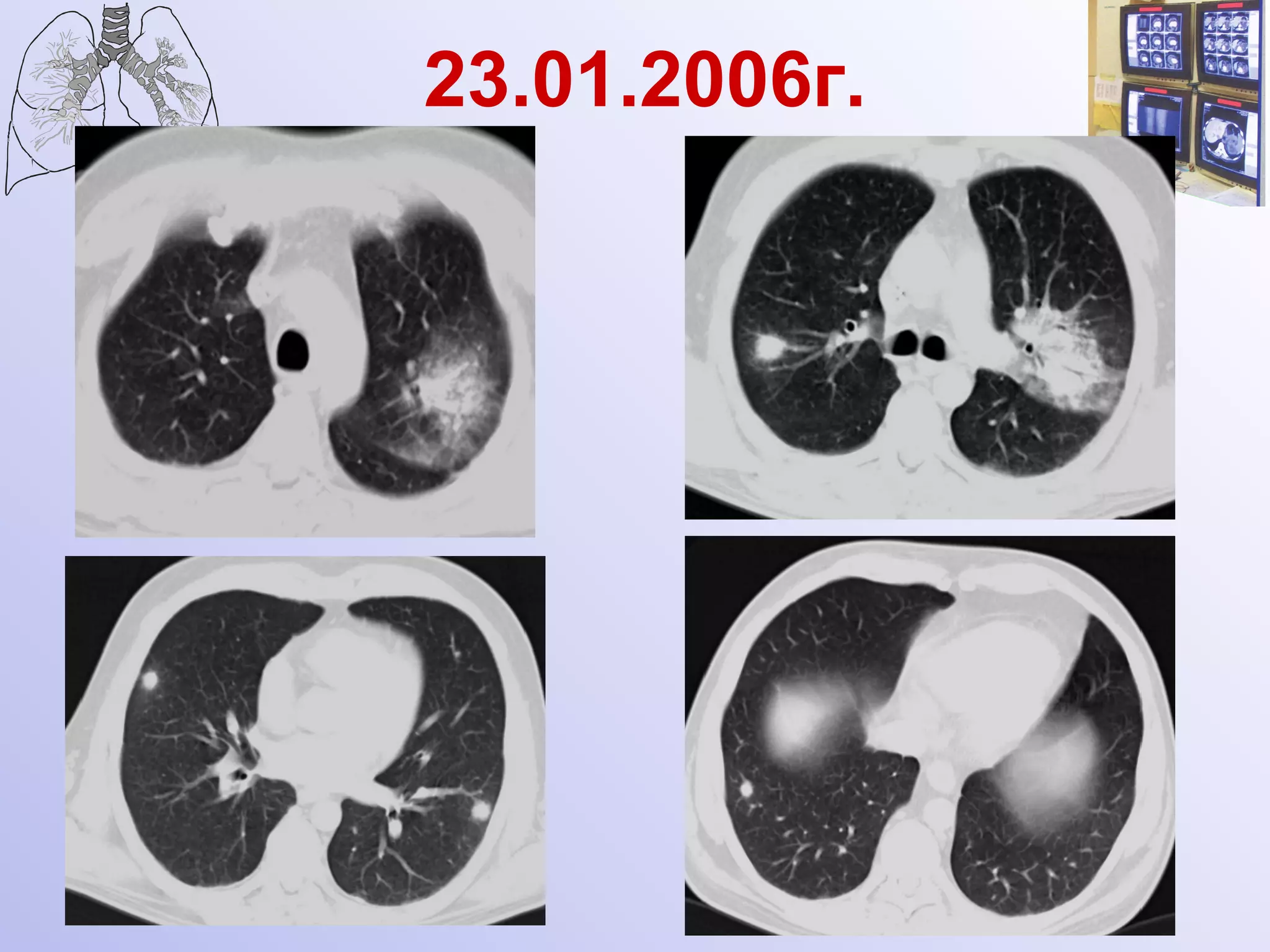 23.01.2006г. 