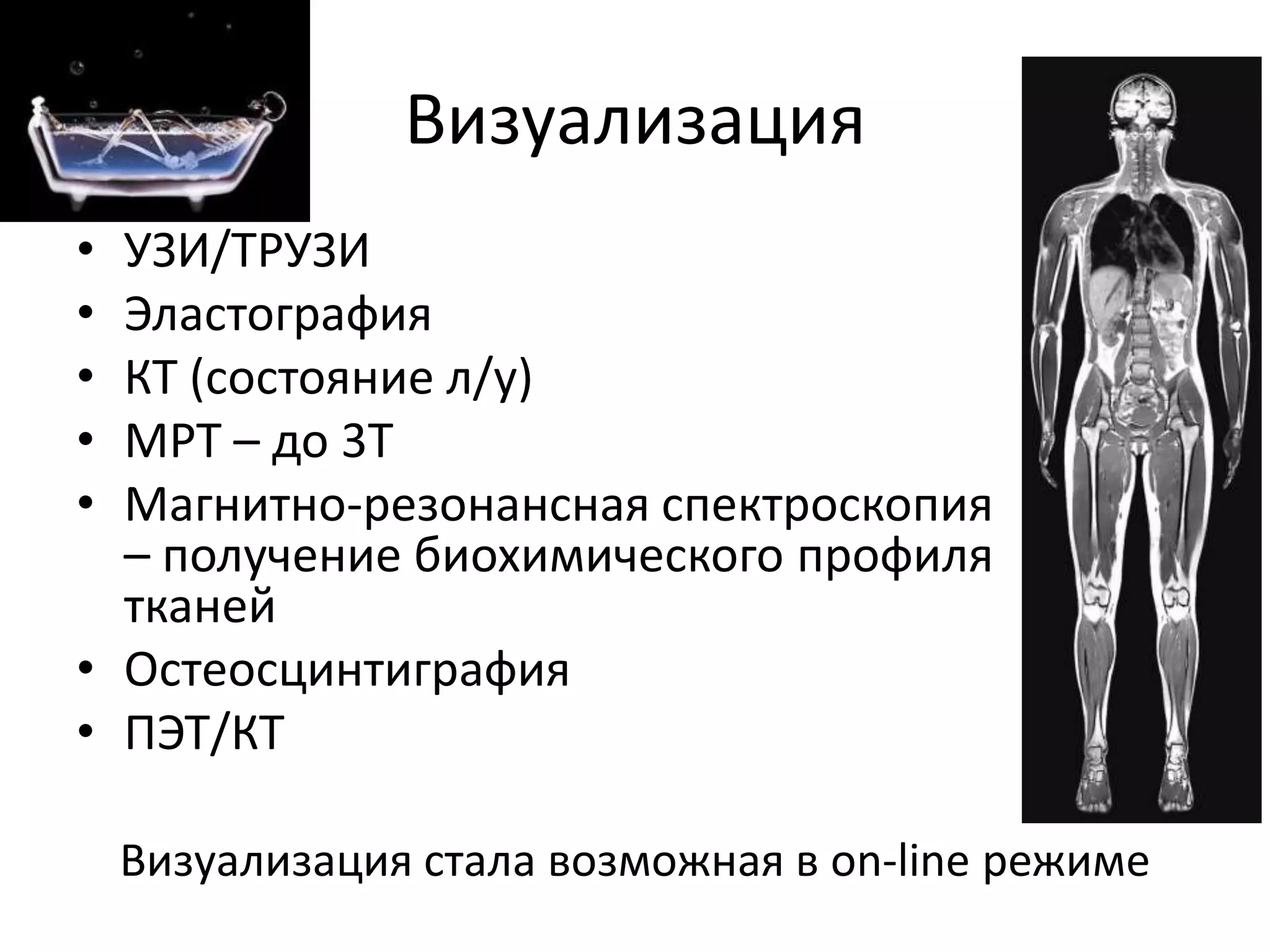 ВизуализацияУЗИ/ТРУЗИЭластографияКТ (состояние л/у)МРТ – до 3ТМагнитно-резонансная спектроскопия – получение биохимического профиля тканейОстеосцинтиграфияПЭТ/КТВизуализация стала возможная в on-line режиме