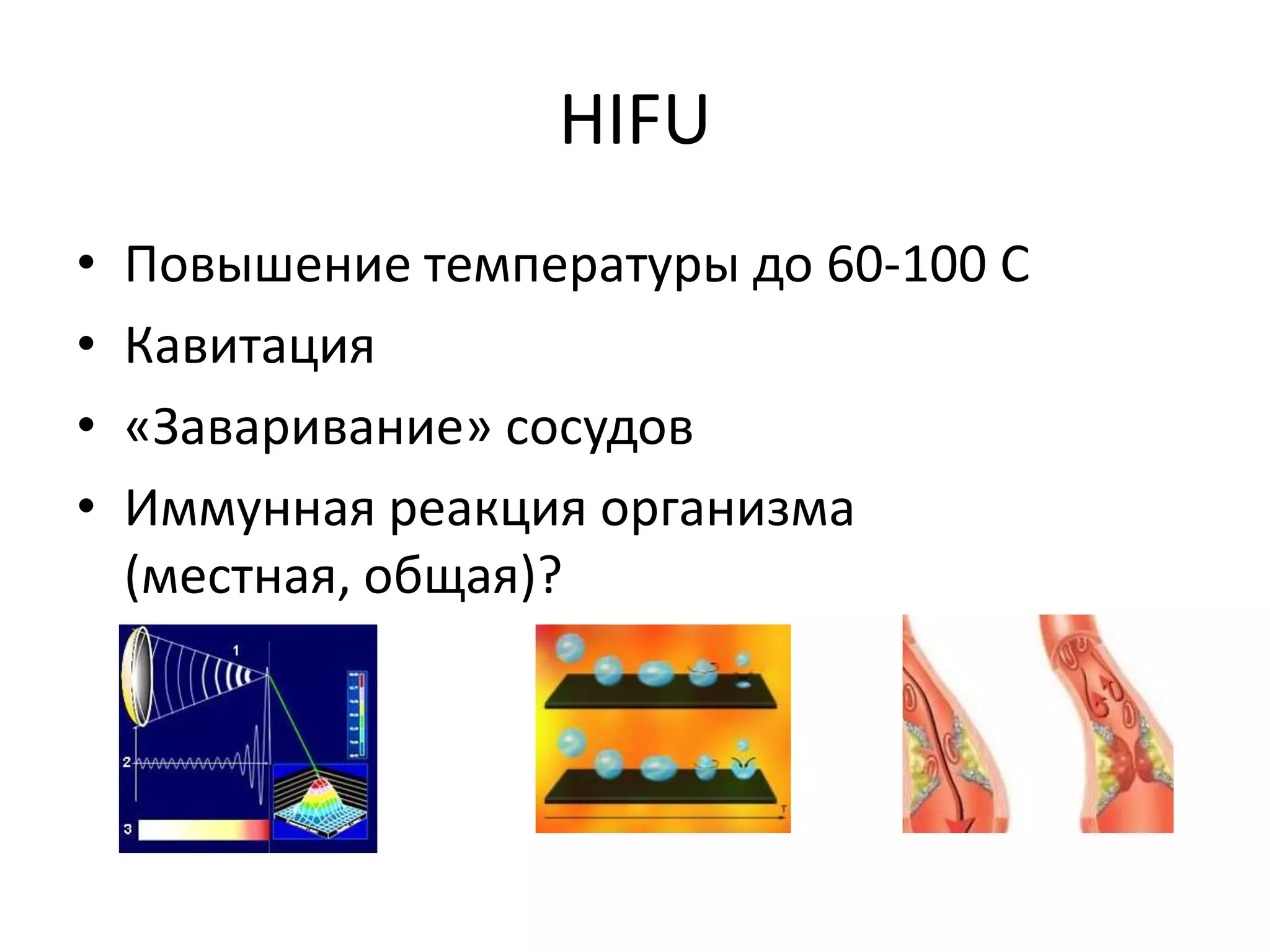 HIFUПовышение температуры до 60-100 СКавитация«Заваривание» сосудовИммунная реакция организма (местная, общая)?