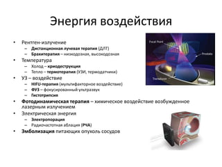 Энергия воздействияРентген-излучение Дистанционная лучевая терапия (ДЛТ)Брахитерапия – низкодозная, высокодознаяТемператураХолод – криодеструкцияТепло – термотерапия (УЗИ, термодатчики)УЗ – воздействиеHIFU-терапия (мультифакторное воздействие)ФУЗ – фокусированный ультразвукГистотрипсияФотодинамическая терапия – химическое воздействие возбужденное лазерным излучениемЭлектрическая энергияЭлектропорацияРадиочастотная аблация (РЧА)Эмболизация питающих опухоль сосудов