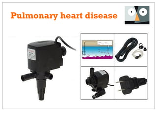Pulmonary heart disease
 