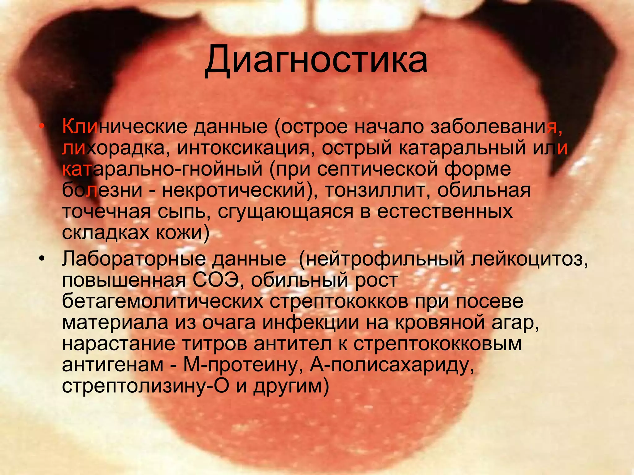 Диагностика Кли нические данные (острое начало заболевани я,   ли хорадка, интоксикация, острый катаральный ил и кат арально-гнойный (при септической форме бо л езни - некротический), тонзиллит, обильная точечная сыпь, сгущающаяся в естественных складках кожи) Лабораторные данные  (нейтрофильный лейкоцитоз, повышенная СОЭ, обильный рост бетагемолитических стрептококков при посеве материала из очага инфекции на кровяной агар, нарастание титров антител к стрептококковым антигенам - М-протеину, А-полисахариду, стрептолизину-О и другим)  