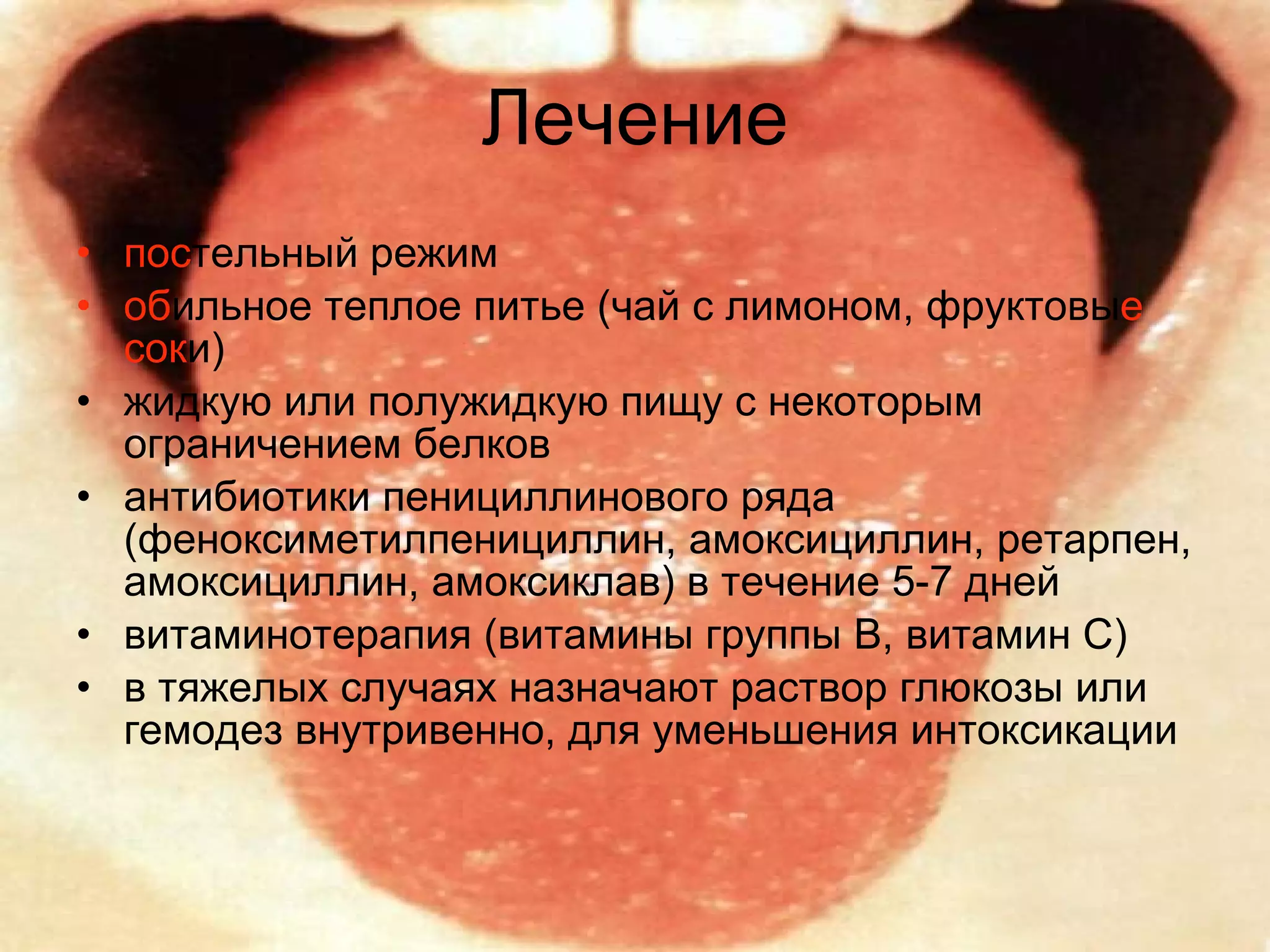 Лечение пос тельный режим об ильное теплое питье (чай с лимоном, фруктовы е   сок и)  жидкую или полужидкую пищу с некоторым ограничением белков  антибиотики пенициллинового ряда (феноксиметилпенициллин, амоксициллин, ретарпен, амоксициллин, амоксиклав) в течение 5-7 дней  витаминотерапия (витамины группы В, витамин С)  в тяжелых случаях назначают раствор глюкозы или гемодез внутривенно, для уменьшения интоксикации  