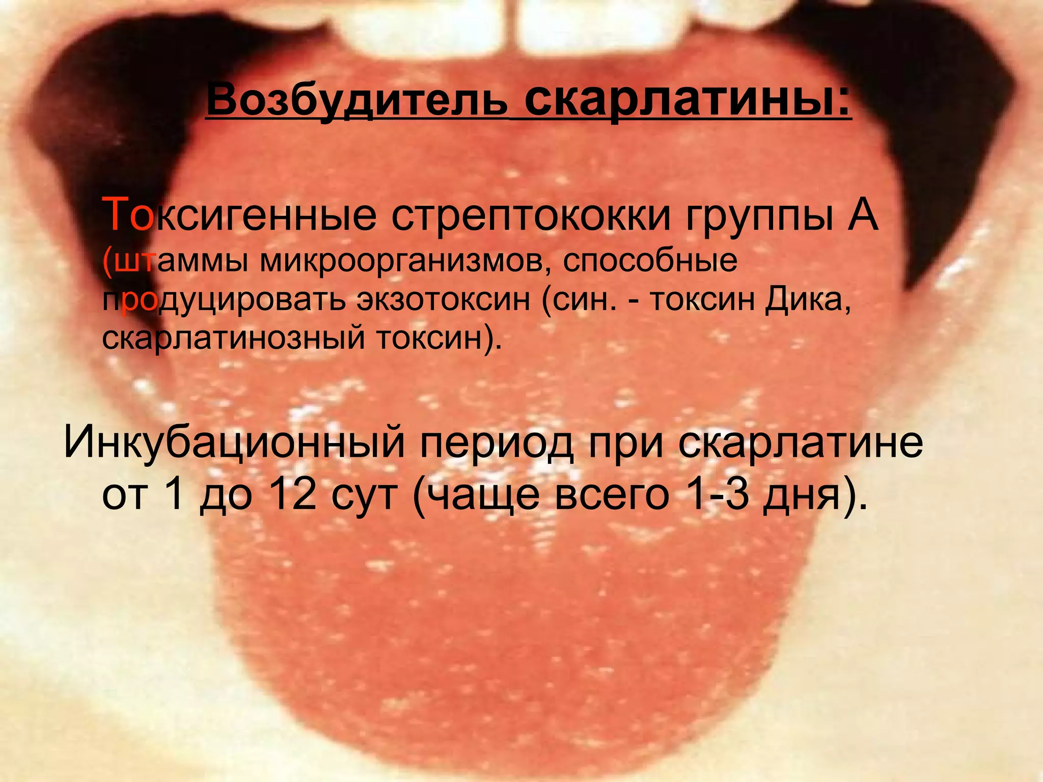 Возбудитель  скарлатины: То ксигенные стрептококки группы А  (шт аммы микроорганизмов, способные п ро дуцировать экзотоксин (син. - токсин Дика, скарлатинозный токсин). Инкубационный период при скарлатине от 1 до 12 сут (чаще всего 1-3 дня).  