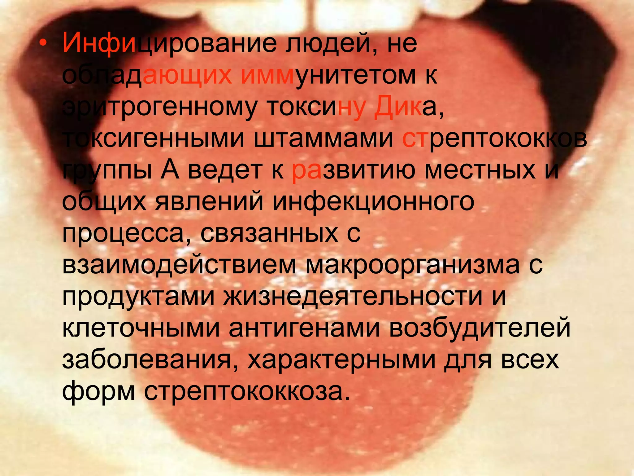 Инфи цирование людей, не облад ающих   имм унитетом к эритрогенному токси ну   Дик а, токсигенными штаммами  ст рептококков группы А ведет к  ра звитию местных и общих явлений инфекционного процесса, связанных с взаимодействием макроорганизма с продуктами жизнедеятельности и клеточными антигенами возбудителей заболевания, характерными для всех форм стрептококкоза. 