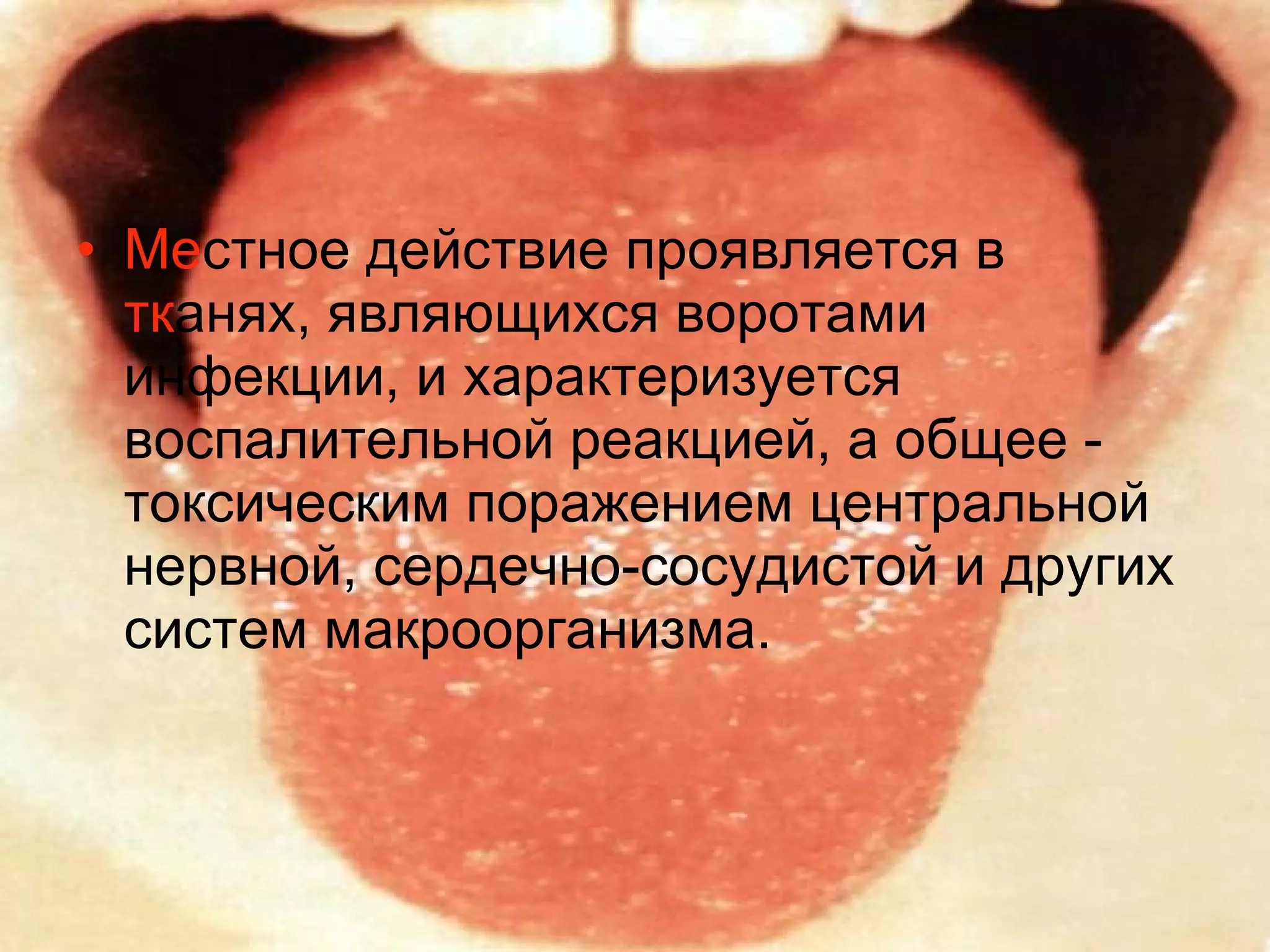 Ме стное действие проявляется в  тк анях, являющихся воротами инфекции, и характеризуется воспалительной реакцией, а общее - токсическим поражением центральной нервной, сердечно-сосудистой и других систем макроорганизма. 