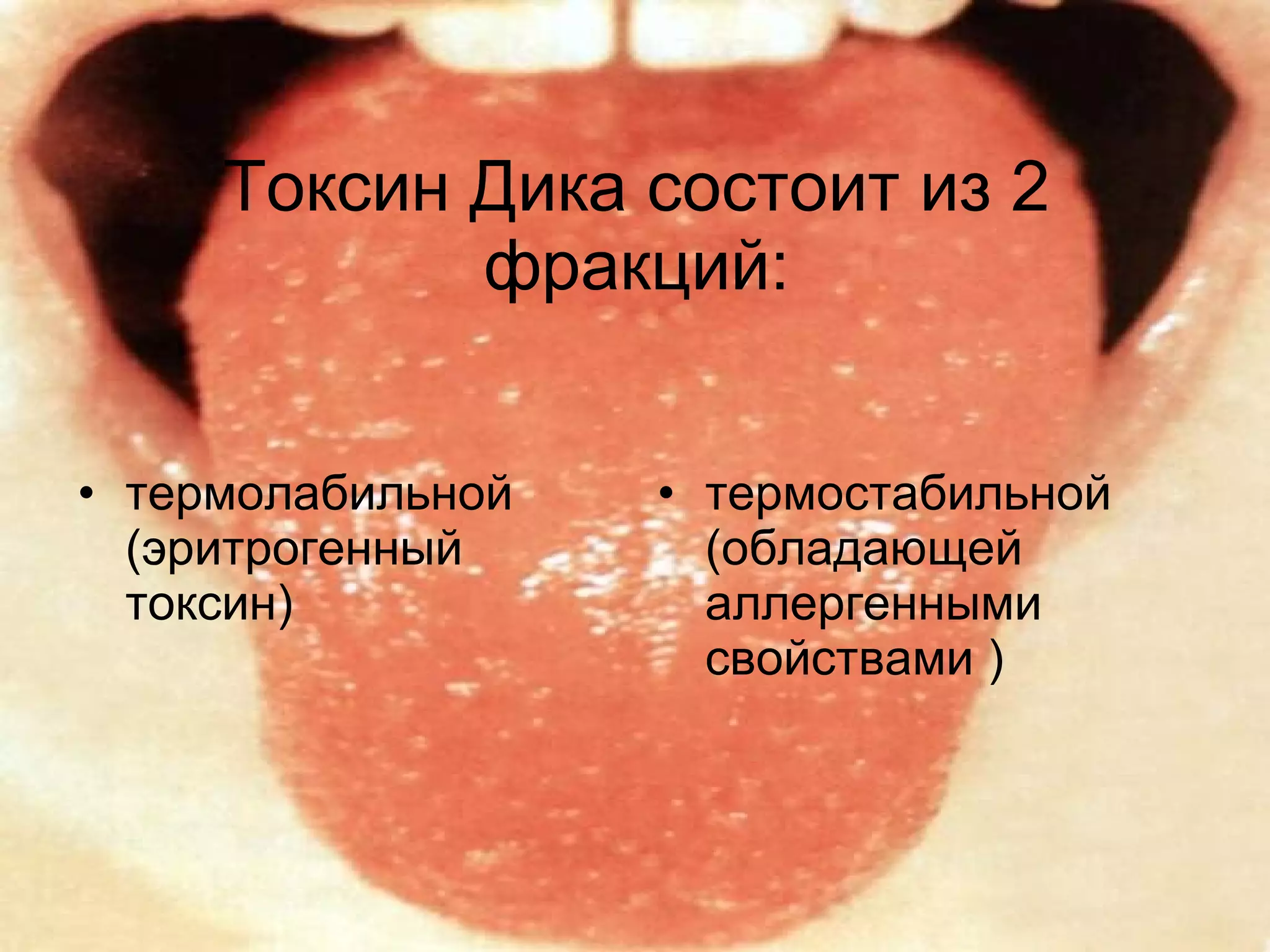 То ксин Дика состоит из  2  фракций: термолабильной (эритрогенный токсин) термостабильной (обладающей аллергенными свойствами ) 