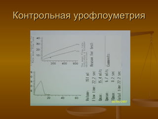 Контрольная урофлоуметрия 