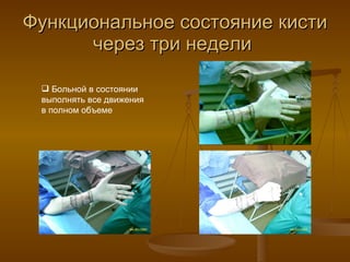 Функциональное состояние кисти через три недели  Больной в состоянии выполнять все движения в полном объеме 