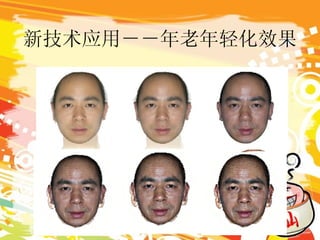 新技术应用－－年老年轻化效果 