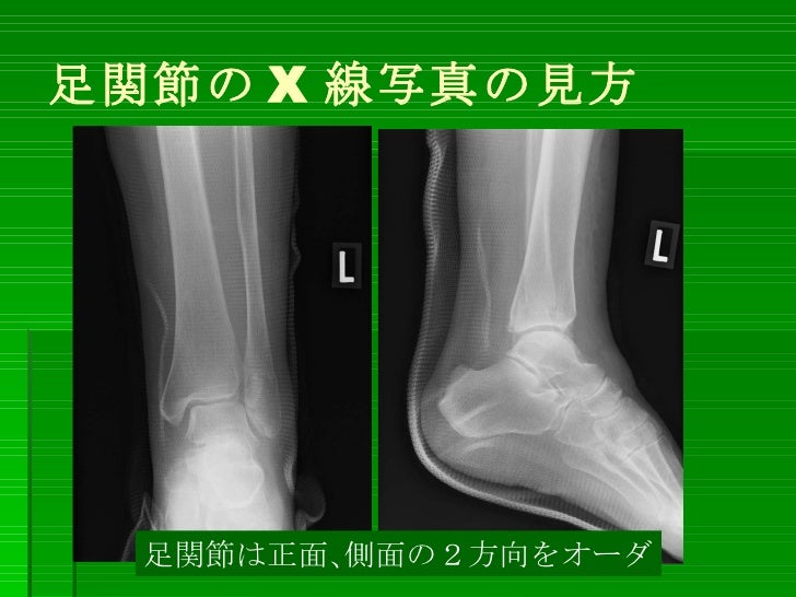 整形外科プライマリーケア レントゲン写真の見方 下肢編 整形外科プライマリーケア レントゲン写真の見方 下肢編