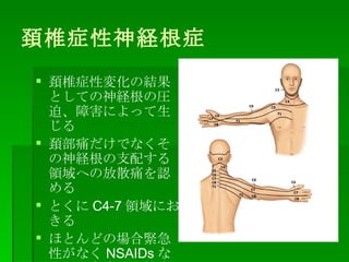 K׵֢U֢ K׵֢ԉ仯νYȤƤUΈRȡϺˤä KʹǤʤU֧䤹IؤηɢʹJ Ȥ C4-7 Iˤ ۤȤɤΈϾoԤʤ NSAIDs ʤɤα毟X 