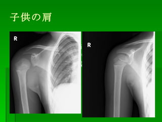 整形外科プライマリーケア レントゲン写真の見方