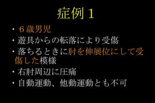 症例１ ・ ６歳男児 ・遊具からの転落により受傷 ・落ちるときに 肘を伸展位にして受傷した 模様 ・右肘周辺に圧痛 ・自動運動、他動運動とも不可 