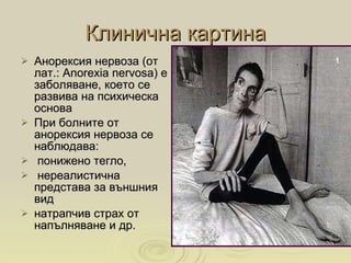 Анорексия | PPT