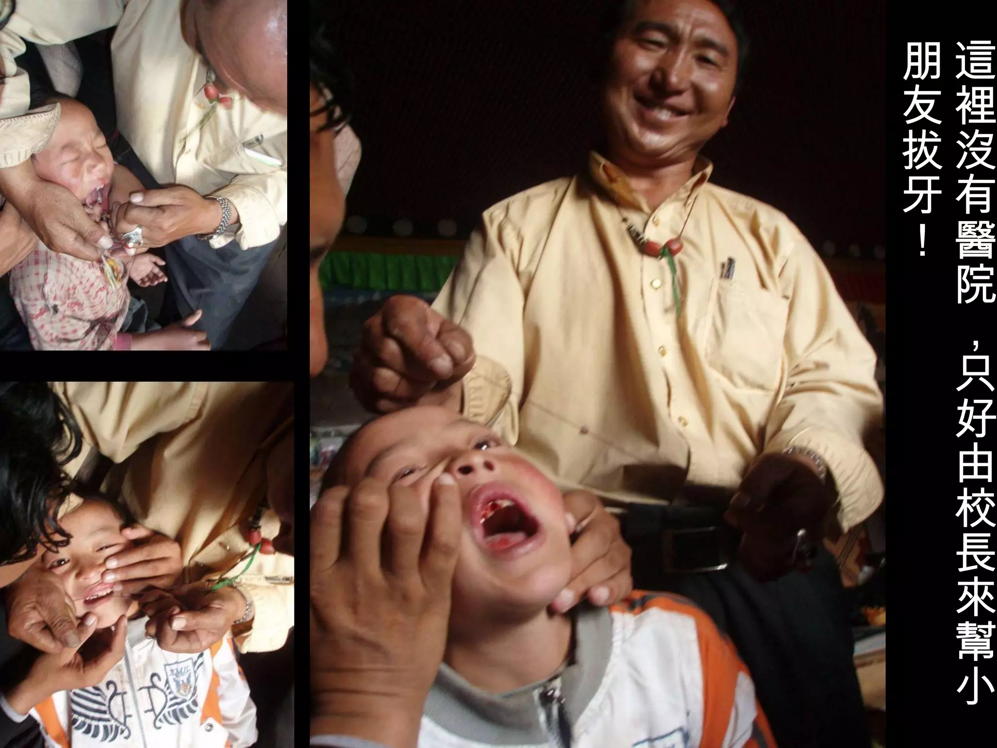 這裡沒有醫院，只好由校長來幫小朋友拔牙！ 