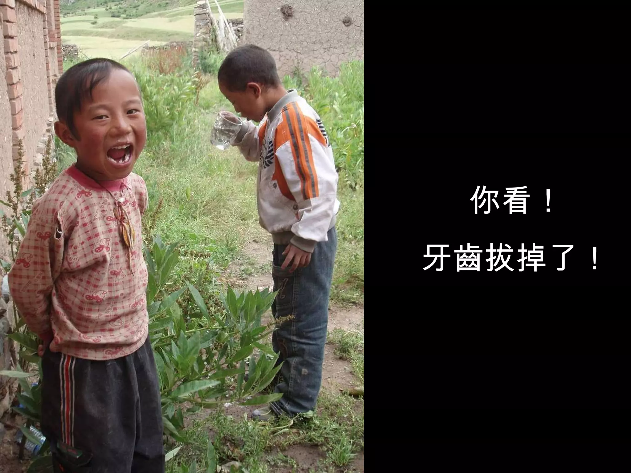 你看！ 牙齒拔掉了！ 