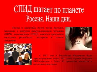 Темпы и масштабы роста числа россиян, живущих с вирусом иммунодефицита человека (ВИЧ), вызывающим СПИД, намного превзошли ожидания российских экспертов в начале эпидемии.  СПИД шагает по планете Россия. Наши дни. С 1987 года в Российской Федерации было зарегистрировано около 300 тысяч случаев передачи ВИЧ-инфекции - более 90 процентов относятся к последним пяти годам. 