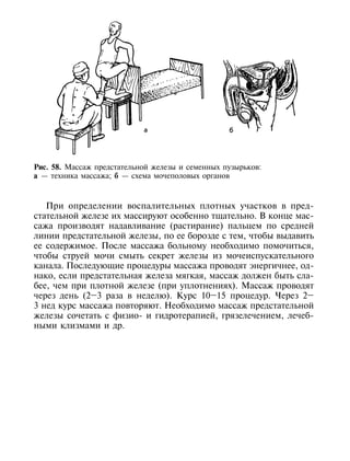 Рис. 58. Массаж предстательной железы и семенных пузырьков:
а — техника массажа; б — схема мочеполовых органов



   При определении воспалительных плотных участков в пред-
стательной железе их массируют особенно тщательно. В конце мас-
сажа производят надавливание (растирание) пальцем по средней
линии предстательной железы, по ее борозде с тем, чтобы выдавить
ее содержимое. После массажа больному необходимо помочиться,
чтобы струей мочи смыть секрет железы из мочеиспускательного
канала. Последующие процедуры массажа проводят энергичнее, од-
нако, если предстательная железа мягкая, массаж должен быть сла-
бее, чем при плотной железе (при уплотнениях). Массаж проводят
через день (2–3 раза в неделю). Курс 10–15 процедур. Через 2–
3 нед курс массажа повторяют. Необходимо массаж предстательной
железы сочетать с физио- и гидротерапией, грязелечением, лечеб-
ными клизмами и др.




190
 