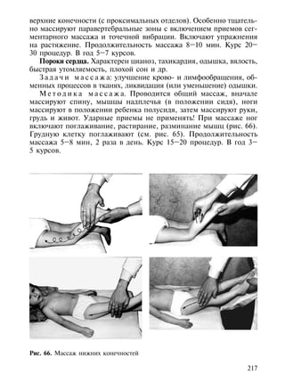 верхние конечности (с проксимальных отделов). Особенно тщатель-
но массируют паравертебральные зоны с включением приемов сег-
ментарного массажа и точечной вибрации. Включают упражнения
на растяжение. Продолжительность массажа 8–10 мин. Курс 20–
30 процедур. В год 5–7 курсов.
   Пороки сердца. Характерен цианоз, тахикардия, одышка, вялость,
быстрая утомляемость, плохой сон и др.
   З а д а ч и м а с с а ж а: улучшение крово- и лимфообращения, об-
менных процессов в тканях, ликвидация (или уменьшение) одышки.
   М е т о д и к а м а с с а ж а. Проводится общий массаж, вначале
массируют спину, мышцы надплечья (в положении сидя), ноги
массируют в положении ребенка полусидя, затем массируют руки,
грудь и живот. Ударные приемы не применять! При массаже ног
включают поглаживание, растирание, разминание мышц (рис. 66).
Грудную клетку поглаживают (см. рис. 65). Продолжительность
массажа 5–8 мин, 2 раза в день. Курс 15–20 процедур. В год 3–
5 курсов.




Рис. 66. Массаж нижних конечностей

                                                                217
 