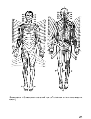 Локализация рефлекторных изменений при заболеваниях кровеносных сосудов
(схема)




                                                                   259
 