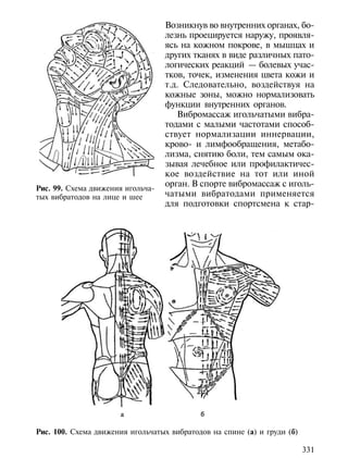 Возникнув во внутренних органах, бо-
                                   лезнь проецируется наружу, проявля-
                                   ясь на кожном покрове, в мышцах и
                                   других тканях в виде различных пато-
                                   логических реакций — болевых учас-
                                   тков, точек, изменения цвета кожи и
                                   т.д. Следовательно, воздействуя на
                                   кожные зоны, можно нормализовать
                                   функции внутренних органов.
                                      Вибромассаж игольчатыми вибра-
                                   тодами с малыми частотами способ-
                                   ствует нормализации иннервации,
                                   крово- и лимфообращения, метабо-
                                   лизма, снятию боли, тем самым ока-
                                   зывая лечебное или профилактичес-
                                   кое воздействие на тот или иной
                                   орган. В спорте вибромассаж с иголь-
Рис. 99. Схема движения игольча-
тых вибратодов на лице и шее       чатыми вибратодами применяется
                                   для подготовки спортсмена к стар-




Рис. 100. Схема движения игольчатых вибратодов на спине (а) и груди (б)

                                                                          331
 
