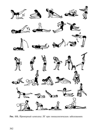 Рис. 111. Примерный комплекс ЛГ при гинекологических заболеваниях




382
 