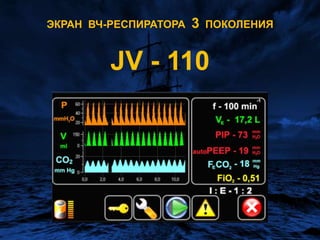 ЭКРАН  ВЧ-РЕСПИРАТОРА  3  ПОКОЛЕНИЯJV - 110