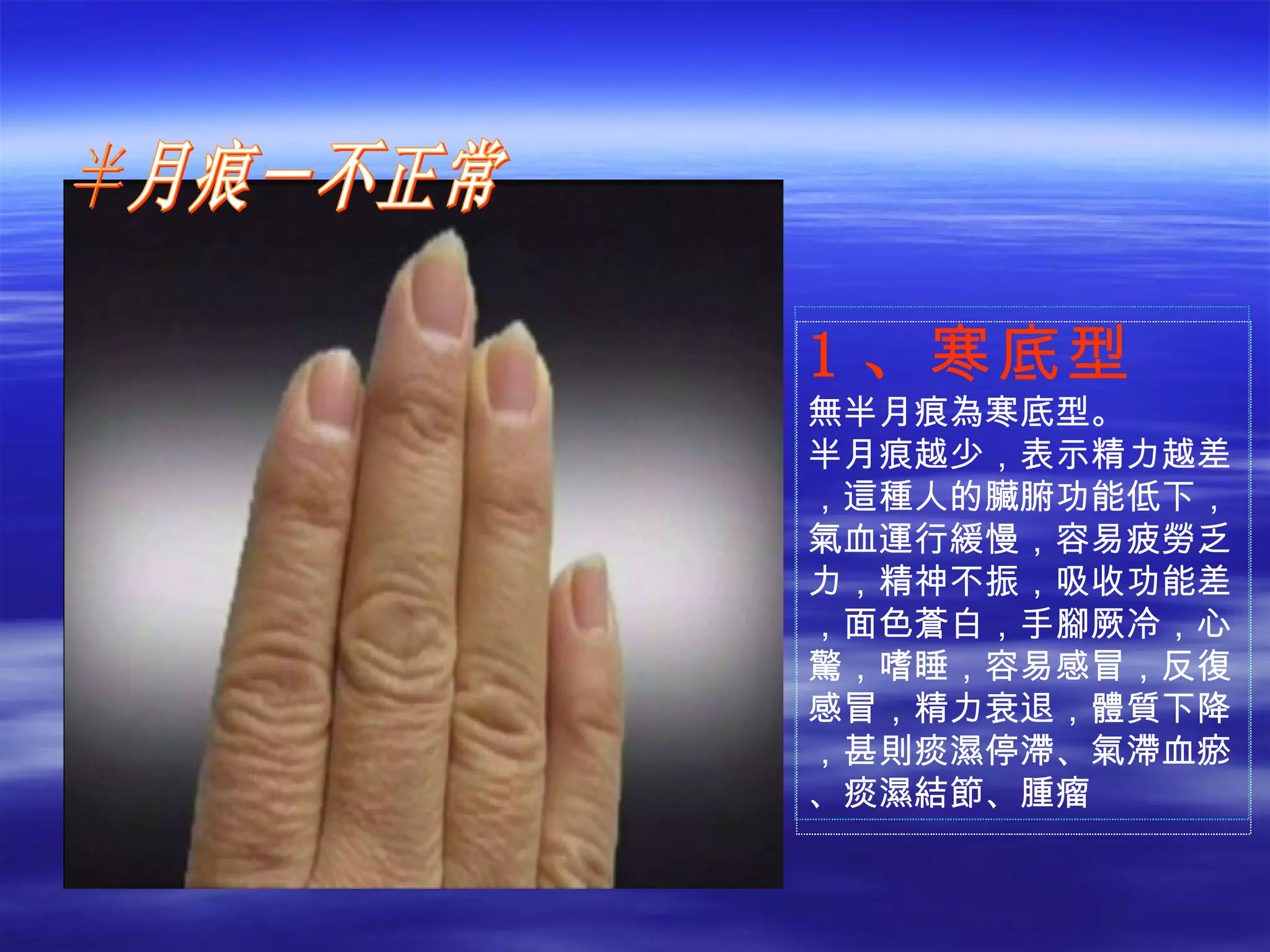 1 、 寒底型 無半月痕為寒底型。 半月痕越少，表示精力越差，這種人的臟腑功能低下，氣血運行緩慢，容易疲勞乏力，精神不振，吸收功能差，面色蒼白，手腳厥冷，心驚，嗜睡，容易感冒，反復感冒，精力衰退，體質下降，甚則痰濕停滯、氣滯血瘀、痰濕結節、腫瘤 半月痕－不正常 