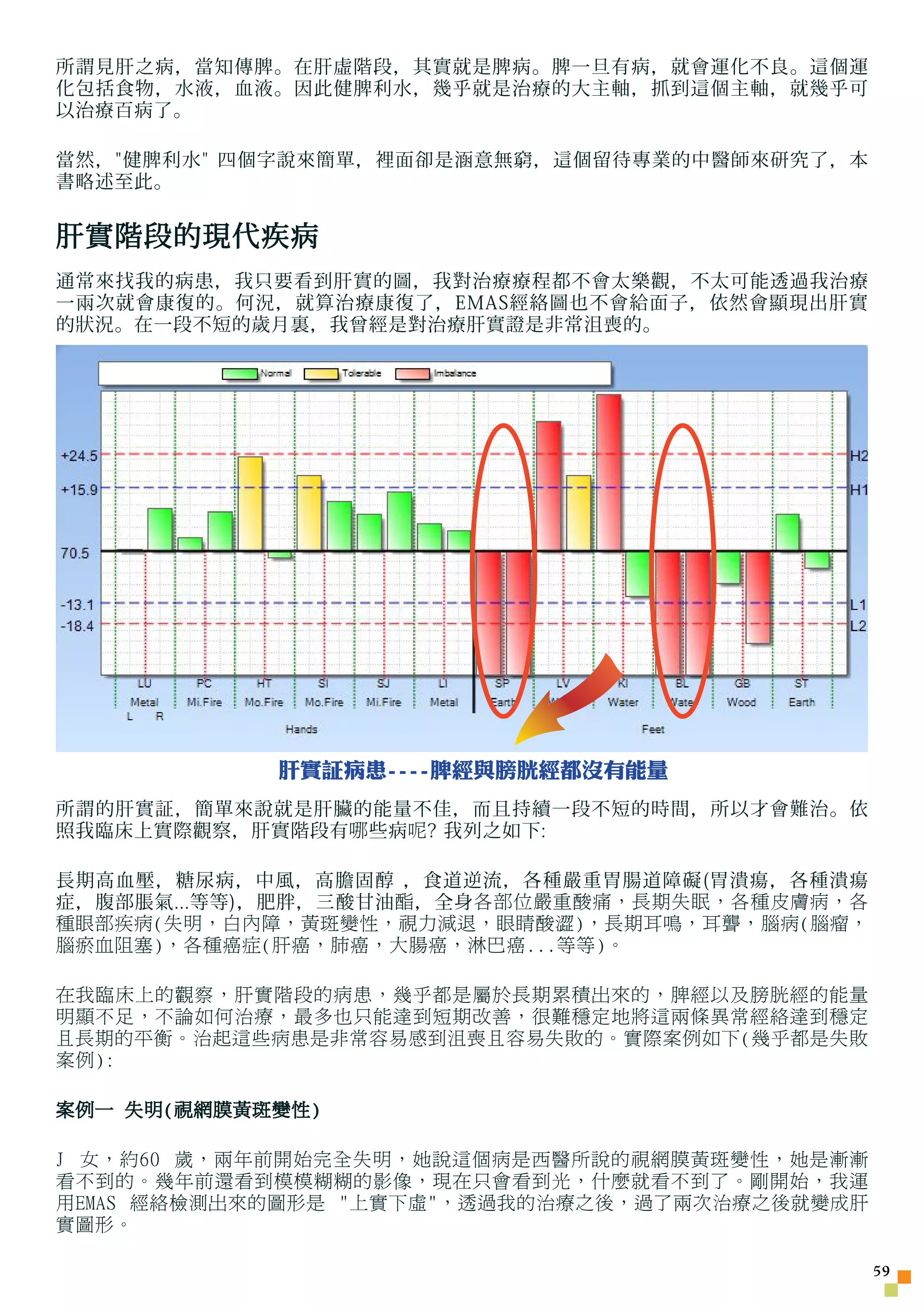 所謂見肝之病，當知傳脾。在肝虛階段，其實就是脾病。脾一旦有病，就會運化不良。這個運
化包括食物，水液，血液。因此健脾利水，幾乎就是治療的大主軸，抓到這個主軸，就幾乎可
以治療百病了。

當然，健脾利水 四個字說來簡單，裡面卻是涵意無窮，這個留待專業的中醫師來研究了，本
書略述至此。


肝實階段的現代疾病
通常來找我的病患，我只要看到肝實的圖，我對治療療程都不會太樂觀，不太可能透過我治療
一兩次就會康復的。何況，就算治療康復了，EMAS經絡圖也不會給面子，依然會顯現出肝實
的狀況。在一段不短的歲月裏，我曾經是對治療肝實證是非常沮喪的。




            肝實証病患----脾經與膀胱經都沒有能量
所謂的肝實証，簡單來說就是肝臟的能量不佳，而且持續一段不短的時間，所以才會難治。依
照我臨床上實際觀察，肝實階段有 哪 些病 呢 ? 我列之如下:

長期高血壓，糖尿病，中風，高膽固醇 ，食道逆流，各種嚴重胃腸道障礙(胃潰瘍，各種潰瘍
症，腹部脹氣...等等)，肥胖，三酸甘油 酯 ，全身 各部位嚴重酸痛，長期失眠，各種皮膚病，各
種眼部疾病(失明，白內障，黃斑變性，視力減退，眼睛酸澀)，長期耳鳴，耳聾，腦病(腦瘤，
腦瘀血阻塞)，各種癌症(肝癌，肺癌，大腸癌，淋巴癌...等等)。

在我臨床上的觀察，肝實階段的病患，幾乎都是屬於長期累積出來的，脾經以及膀胱經的能量
明顯不足，不論如何治療，最多也只能達到短期改善，很難穩定地將這兩條異常經絡達到穩定
且長期的平衡。治起這些病患是非常容易感到沮喪且容易失敗的。實際案例如下(幾乎都是失敗
案例):

案例一 失明(視網膜黃斑變性)

J 女，約60 歲，兩年前開始完全失明，她說這個病是西醫所說的視網膜黃斑變性，她是漸漸
看不到的。幾年前還看到模模糊糊的影像，現在只會看到光，什麼就看不到了。剛開始，我運
用EMAS 經絡檢測出來的圖形是 上實下虛，透過我的治療之後，過了兩次治療之後就變成肝
實圖形。

                                                  5
 