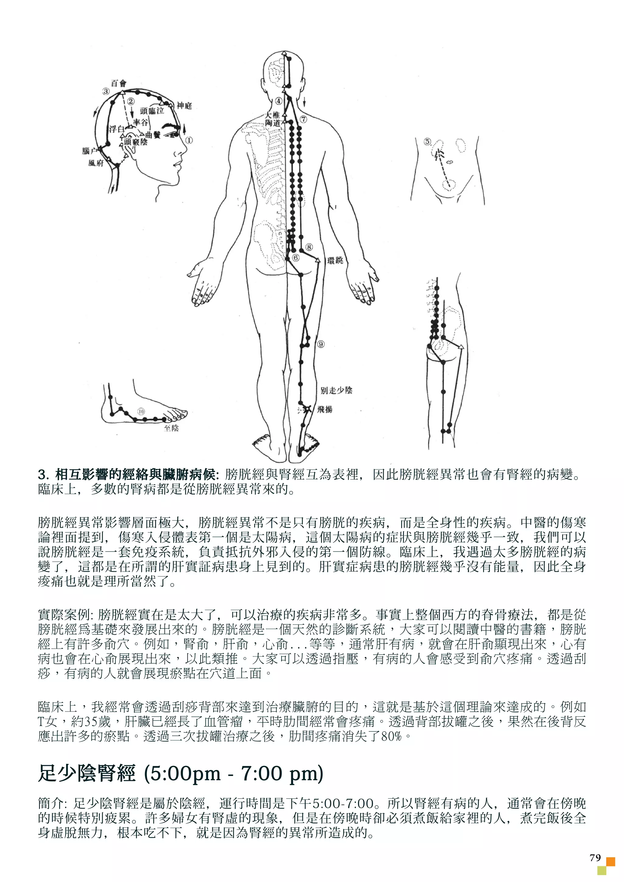 3. 相互影響的經絡與臟腑病候: 膀胱經與腎經互為表裡，因此膀胱經異常也會有腎經的病變。
臨床上，多數的腎病都是從膀胱經異常來的。

膀胱經異常影響層面極大，膀胱經異常不是只有膀胱的疾病，而是全身性的疾病。中醫的傷寒
論裡面提到，傷寒入侵體表第一個是太陽病，這個太陽病的症狀與膀胱經幾乎一致，我們可以
說膀胱經是一套免疫系統，負責抵抗外邪入侵的第一個防線。臨床上，我遇過太多膀胱經的病
變了，這都是在所謂的肝實証病患身上見到的。肝實症病患的膀胱經幾乎沒有能量，因此全身
痠 痛也就是理所當然了。

實際案例: 膀胱經實在是太大了，可以治療的疾病非常多。事實上整個西方的脊骨療法，都 是從
膀胱經為基礎來發展出來的。膀胱經是一個天然的診斷系統，大家可以閱讀中醫的書籍，膀胱
經上有許多俞穴。例如，腎俞，肝俞，心俞...等等，通常肝有病，就會在肝俞顯現出來，心有
病也會在心俞展現出來，以此類推。大家可以透過指壓，有病的人會感受到俞穴疼痛。透過刮
痧，有病的人就會展現瘀點在穴道上面。

臨床上，我經常會透過刮痧背部來達到治療臟腑的目的，這就是基於這個理論來達成的。例如
T女，約35歲，肝臟已經長了血管瘤，平時肋間經常會疼痛。透過背部拔罐之後，果然在後背反
應出許多的瘀點。透過三次拔罐治療之後，肋間疼痛消失了80%。


足少陰腎經 (5:00pm - 7:00 pm)
簡介: 足少陰腎經是屬於陰經，運行時間是下午5:00-7:00。所以腎經有病的人，通常會在傍晚
的時候特別疲累。許多婦女有腎虛的現象，但是在傍晚時卻必須煮飯給家裡的人，煮完飯後全
身虛脫無力，根本吃不下，就是因為腎經的異常所造成的。
                                                  7
 