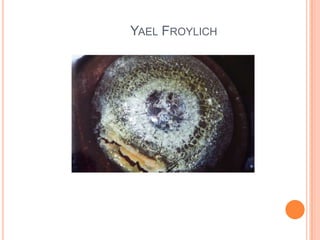Yael Froylichיעל פרוייליך