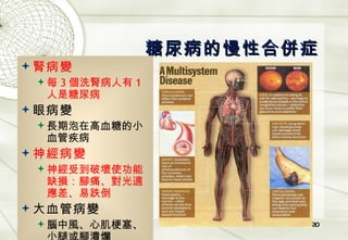 糖尿病的慢性合併症 腎病變 每 3 個洗腎病人有 1 人是糖尿病 眼病變 長期泡在高血糖的小血管疾病 神經病變 神經受到破壞使功能缺損：腳痛、對光適應差、易跌倒 大血管病變 腦中風、心肌梗塞、小腿或腳潰爛 