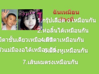 ฉันเหมือนน้องที่1.กรุ๊ปเลือด o เหมือนกัน2.ห่อลิ้นได้เหมือนกัน3.มีตาชั้นเดียวเหมือนกัน4.มีสีตาเหมือนกัน5.หัวแม่มืองอได้เหมือนกัน6.มีติ่งหูเหมือนกัน7.เส้นผมตรงเหมือนกัน