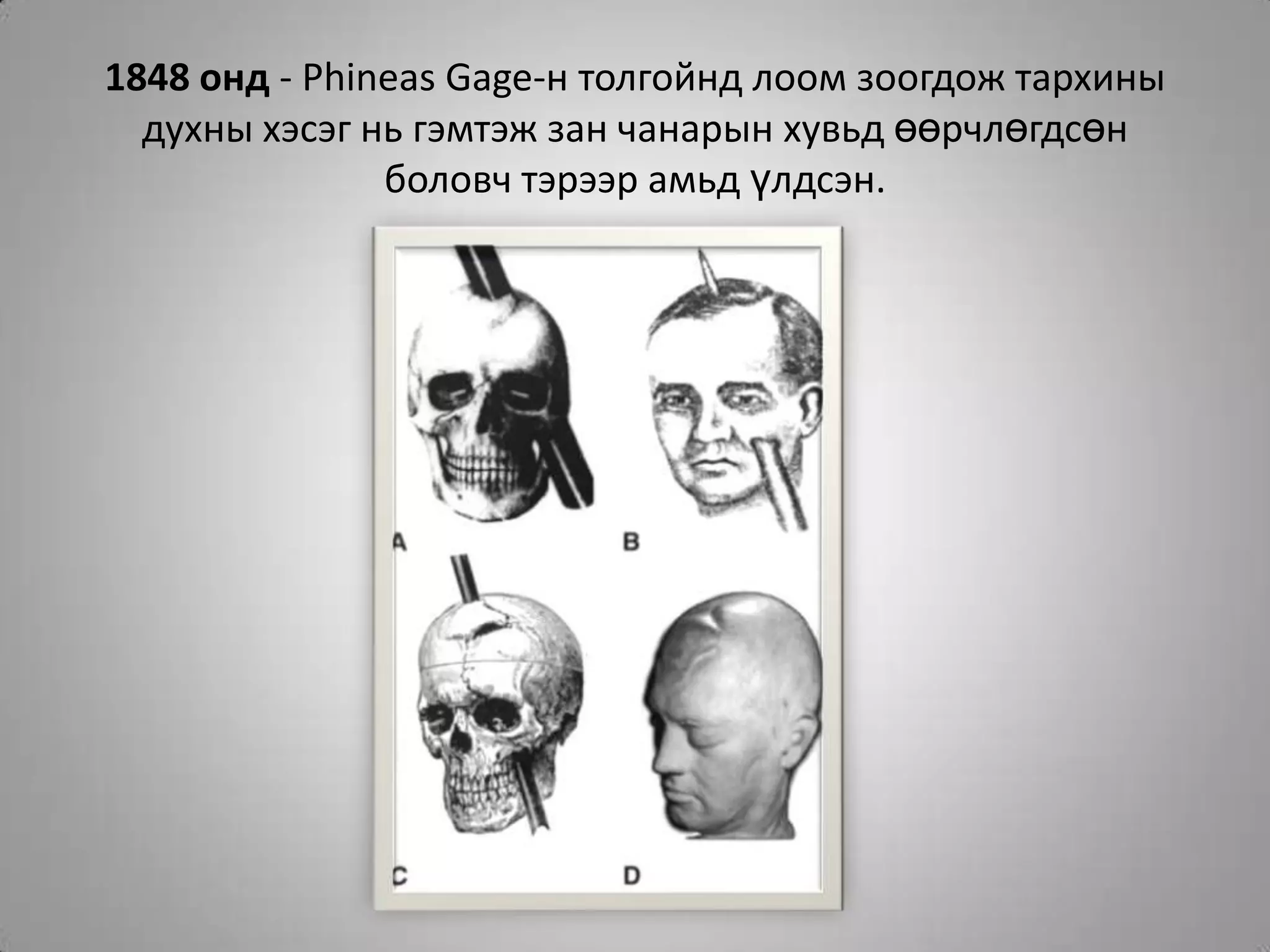 1848 онд - Phineas Gage-н толгойнд лоом зоогдож тархины духны хэсэг нь гэмтэж зан чанарын хувьд өөрчлөгдсөн боловч тэрээр амьд үлдсэн.