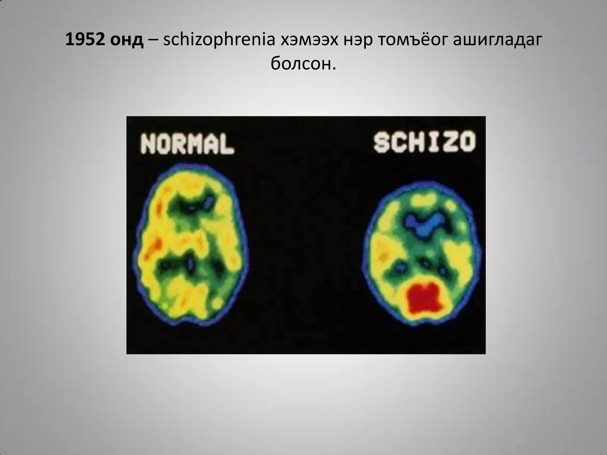 1952 онд – schizophrenia хэмээх нэр томъёог ашигладаг болсон.