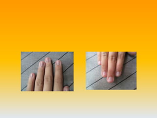 ฉันมีเล็บเหมือนน้องน้องฉัน