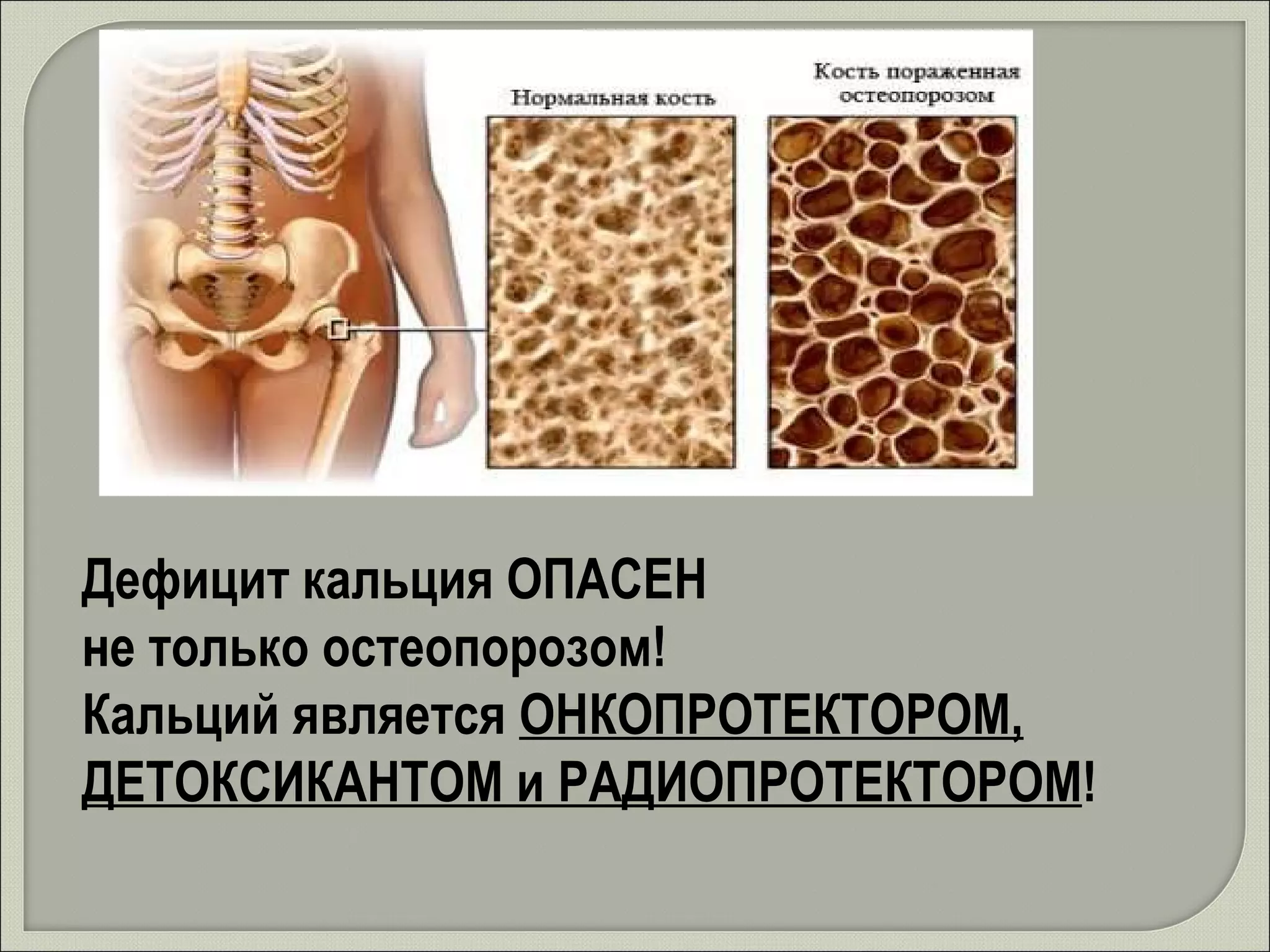 Дефицит кальция ОПАСЕН  не только остеопорозом! Кальций является  ОНКОПРОТЕКТОРОМ, ДЕТОКСИКАНТОМ и РАДИОПРОТЕКТОРОМ !   