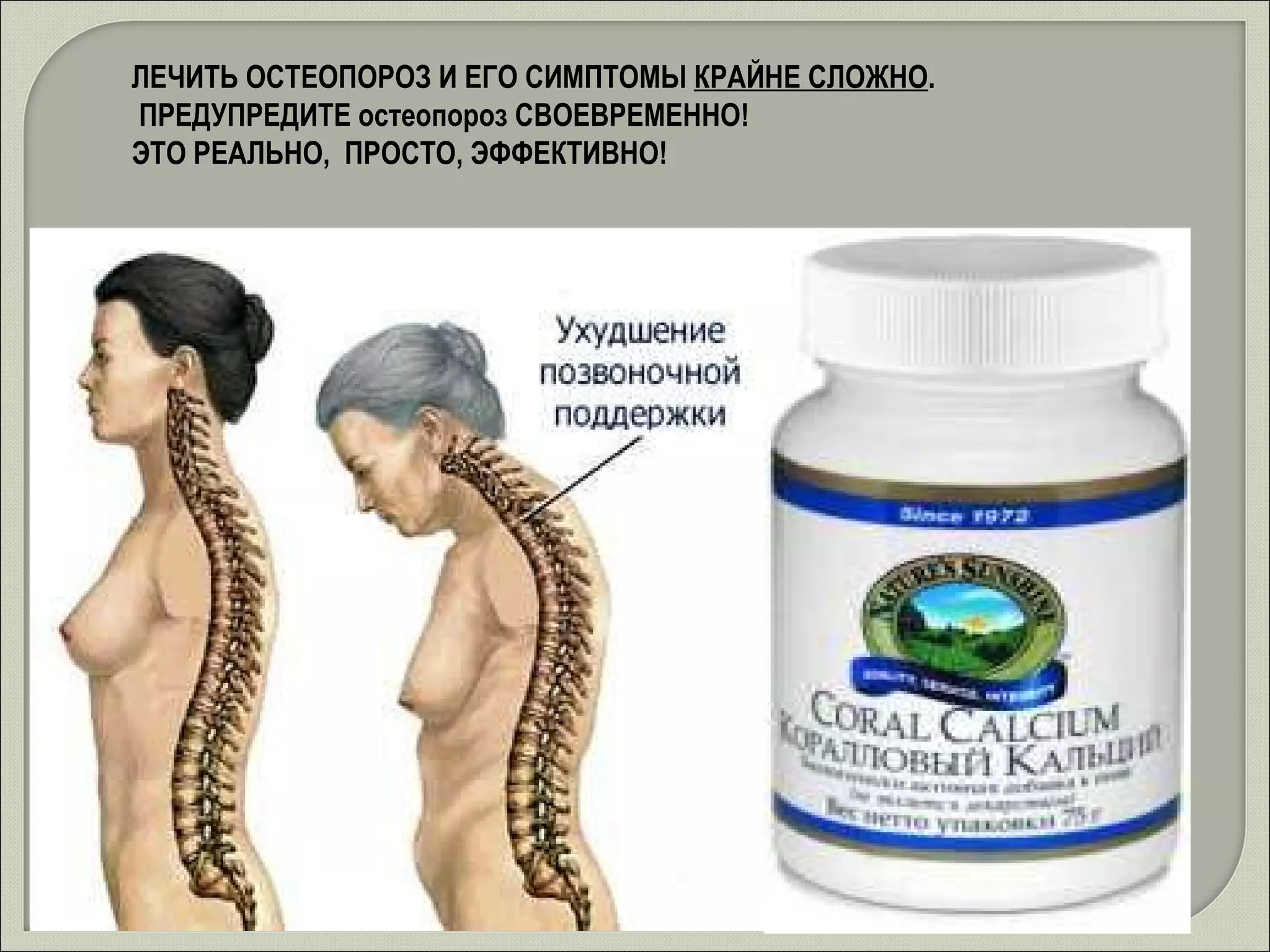 ЛЕЧИТЬ ОСТЕОПОРОЗ И ЕГО СИМПТОМЫ  КРАЙНЕ СЛОЖНО . ПРЕДУПРЕДИТЕ остеопороз СВОЕВРЕМЕННО!  ЭТО РЕАЛЬНО,  ПРОСТО, ЭФФЕКТИВНО! 
