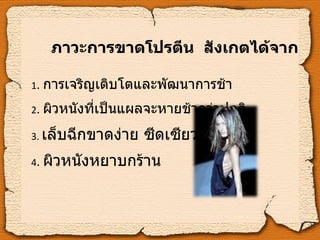 ภาวะการขาดโปรตีน  สังเกตได้จาก 1 .   การเจริญเติบโตและพัฒนาการช้า 2 .   ผิวหนังที่เป็นแผลจะหายช้ากว่าปกติ 3.   เล็บฉีกขาดง่าย ซีดเซียว 4 .   ผิวหนังหยาบกร้าน 