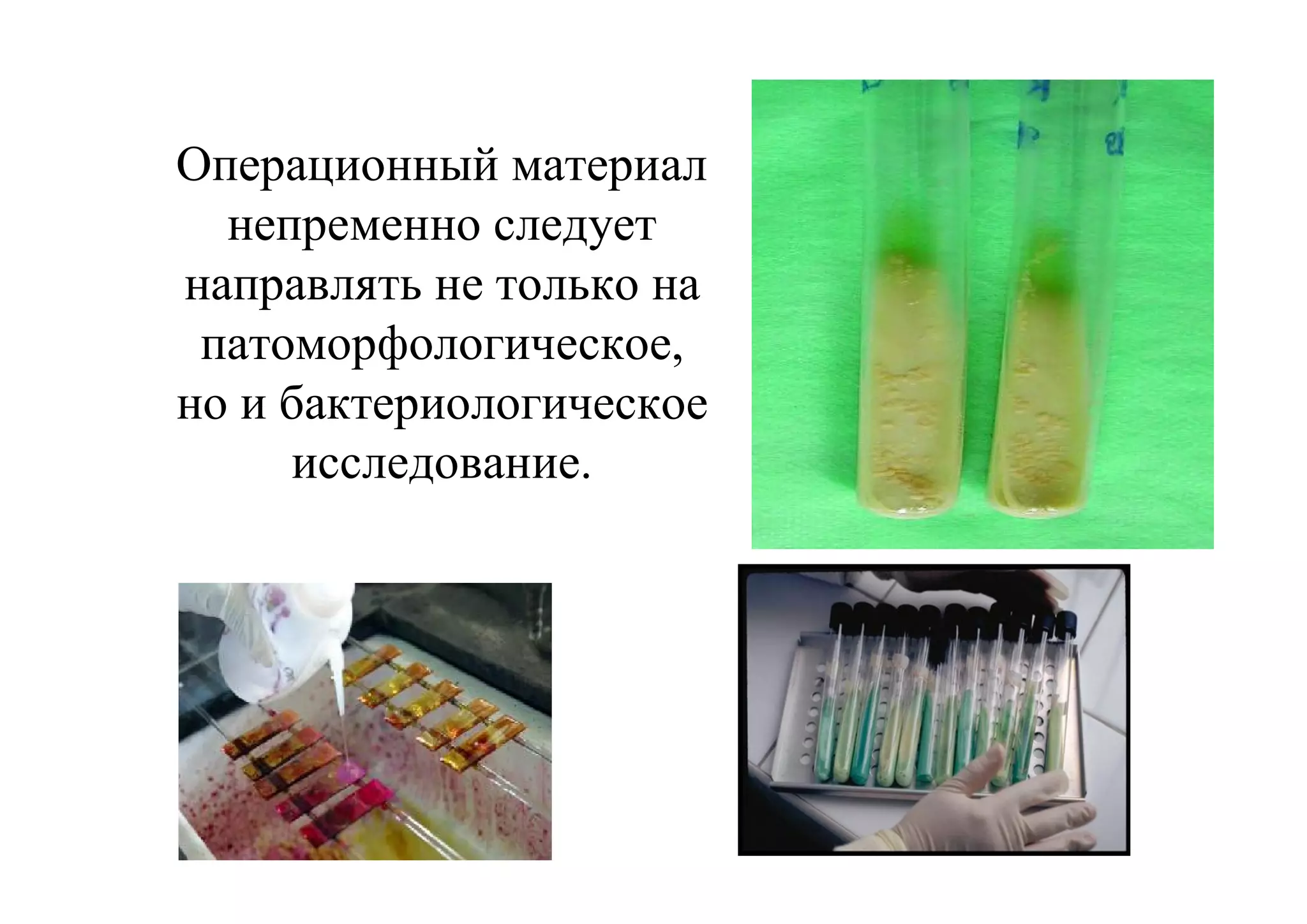 Операционный материал
  непременно следует
направлять не только на
 патоморфологическое,
но и бактериологическое
     исследование.
 