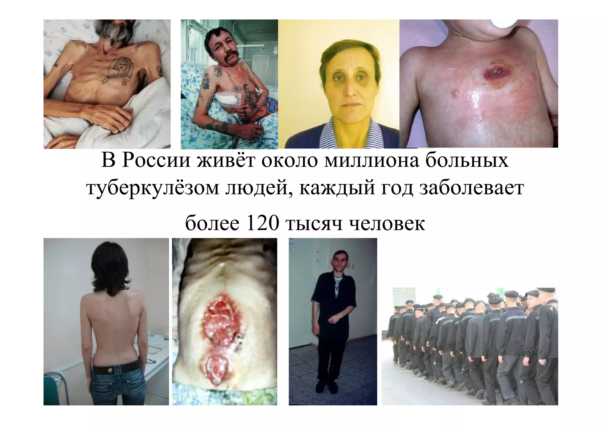 В России живёт около миллиона больных
туберкулёзом людей, каждый год заболевает
         более 120 тысяч человек
 