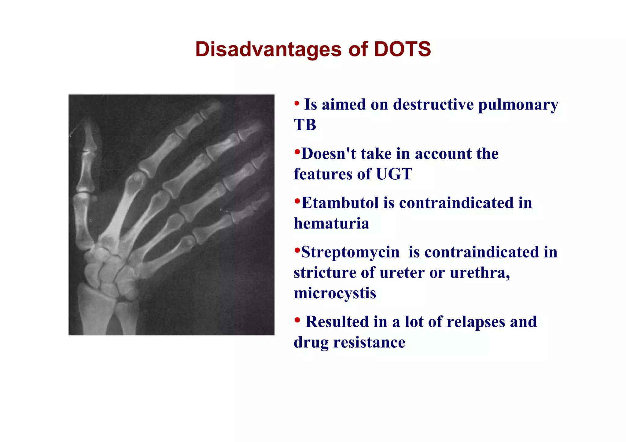 Disadvantages of DOTS

        • Is aimed on destructive pulmonary
        TB
        •Doesn't take in account the
        features of UGT
        •Etambutol is contraindicated in
        hematuria
        •Streptomycin    is contraindicated in
        stricture of ureter or urethra,
        microcystis
        • Resulted in a lot of relapses and
        drug resistance
 