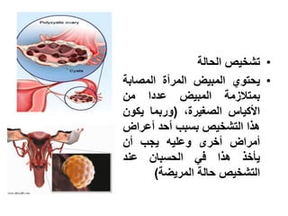‫• تشخٌص الحالة‬
‫• ٌحتوي المبٌض المرأة المصابة‬
‫بمتالزمة المبٌض عددا من‬
‫األكٌاس الصغٌرة، (وربما ٌكون‬
‫هذا التشخٌص بسبب أحد أعراض‬
‫أمراض أخرى وعلٌه ٌجب أن‬
‫ٌؤخذ هذا فً الحسبان عند‬
       ‫التشخٌص حالة المرٌضة)‬
 