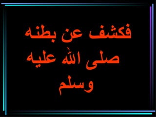 فكشف عن بطنه   صلى الله عليه وسلم     